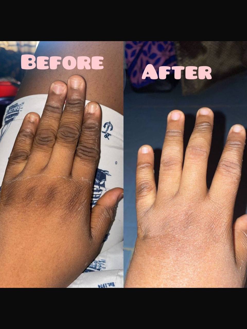 Radiant Skin Lightening Cream