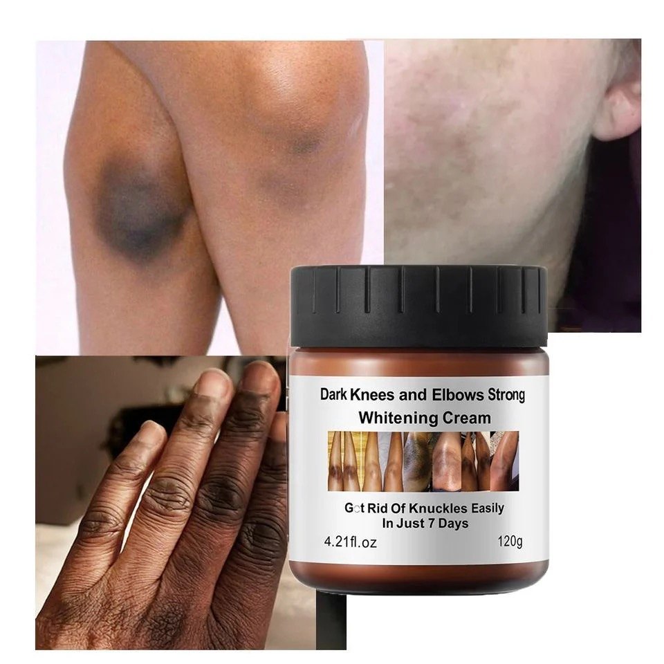 Dark Knuckles Brightening Kit