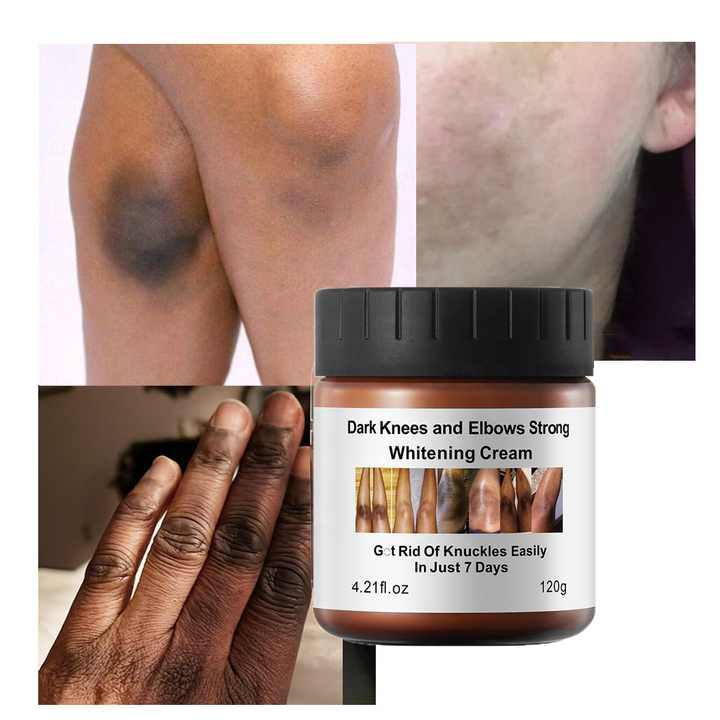 Radiant Skin Lightening Cream